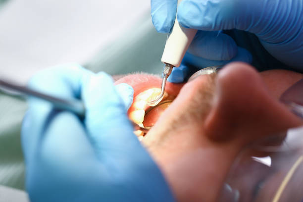Best Emergency Gum Treatment in Monmouth Beach, NJ